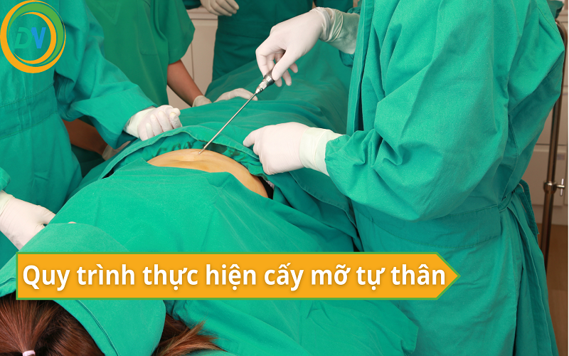 chi phí cấy mỡ tự thân