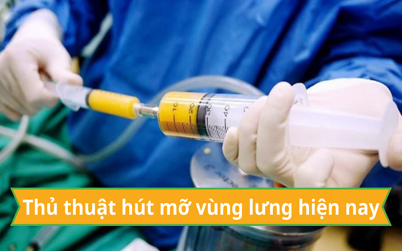 Hút mỡ nách bao nhiêu tiền