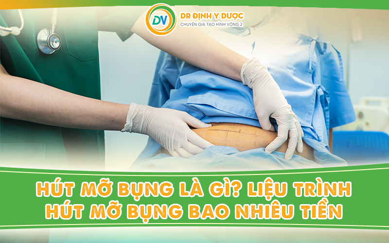 Hút mỡ bụng? Liệu trình hút mỡ bụng bao nhiêu tiền?