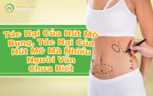 tác hại của hút mỡ bụng, tác hại của hút mỡ mà nhiều người vẫn chưa biết