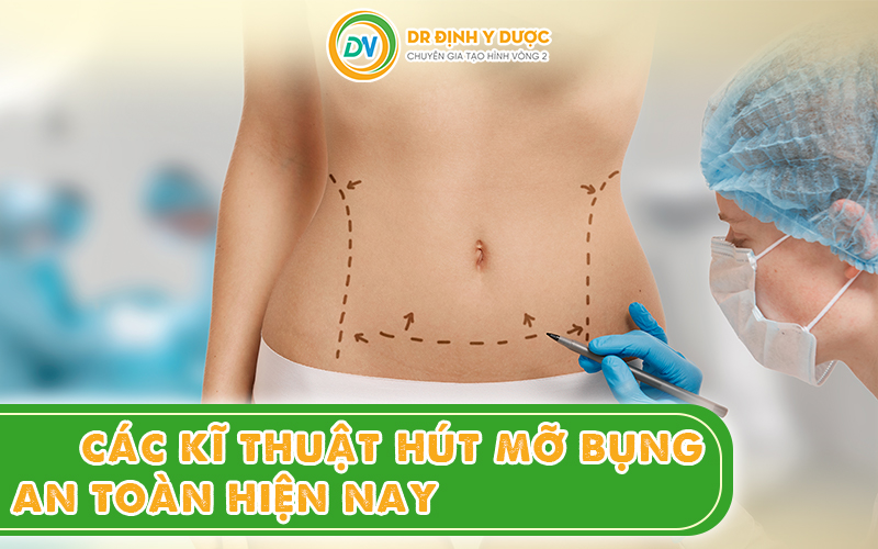 Các kĩ thuật hút mỡ bụng hiện nay