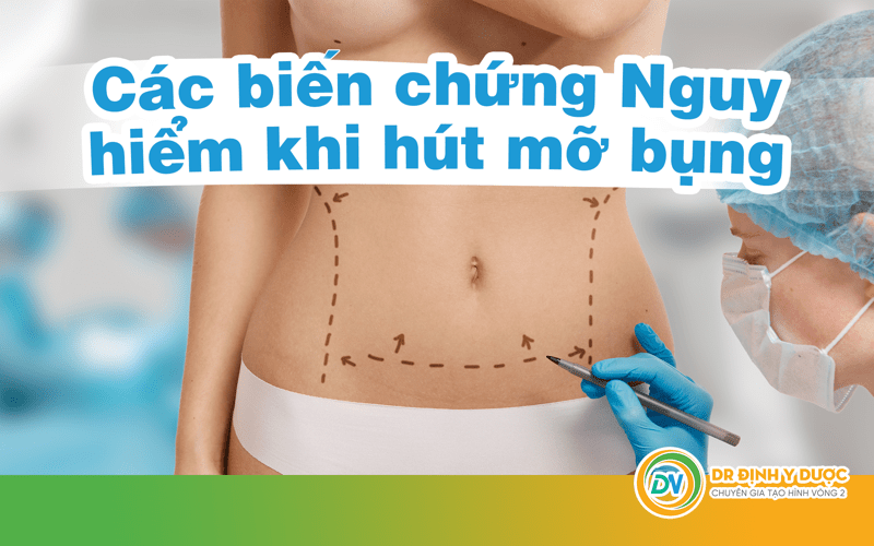 Nguy hiểm khi hút mỡ bụng có thể tử vong