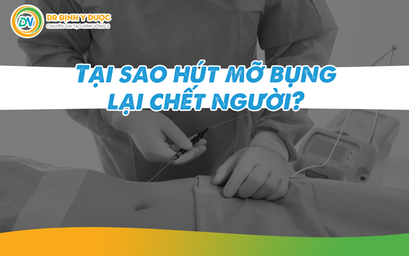 Tại sao hút mỡ bụng lại chết người?