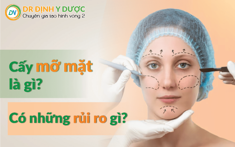 Cấy mỡ mặt là gì? Có những rủi ro gì?