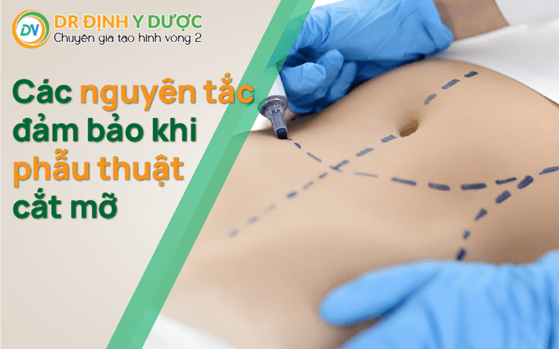 nguyên tắt khi phẫu thuật cắt mỡ