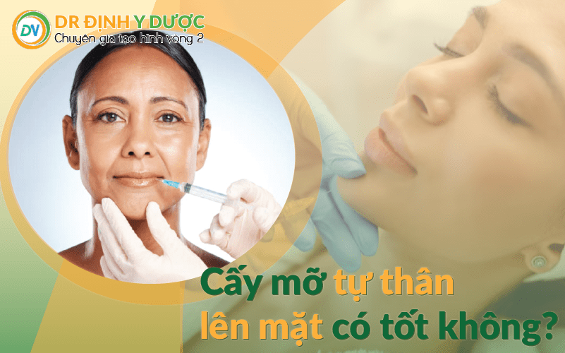 cấy mỡ tự thân lên mặt có tốt không