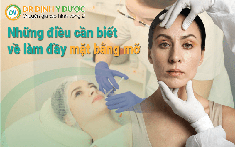 những điều cần biết về làm đầy mặt bằng mỡ