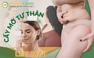 cấy mỡ tự thân lên mặt