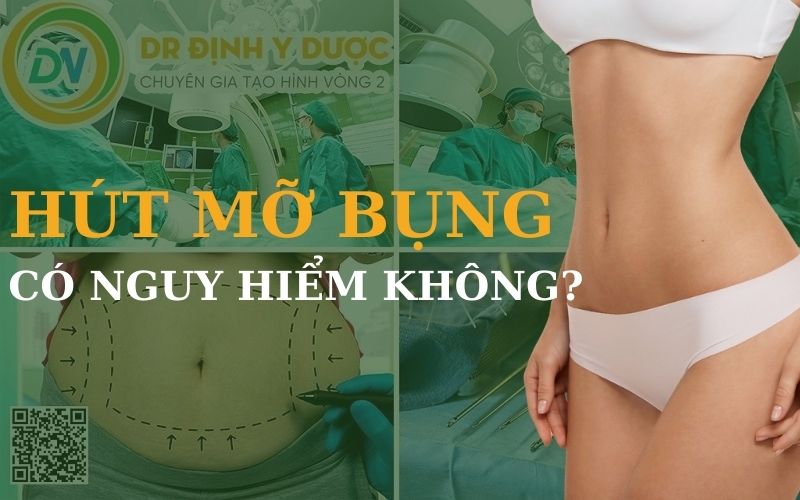 hút mỡ bụng có nguy hiểm không