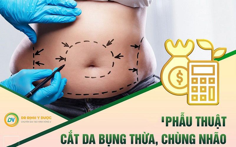 Phẫu thuật cắt da bụng và loại bỏ da thừa