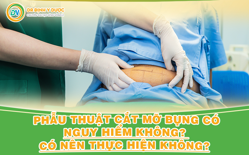 Phẫu thuật cắt mỡ bụng có nguy hiểm không?