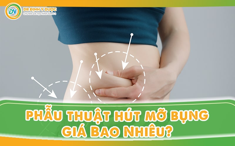 Phẫu Thuật Hút Mỡ Bụng Giá Bao Nhiêu?