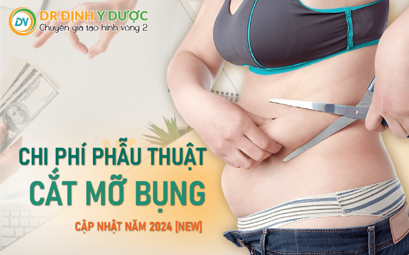 chi phí cắt mỡ bụng