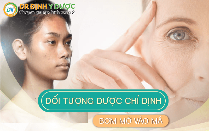 đối tượng được chỉ định bơm mỡ má hóp