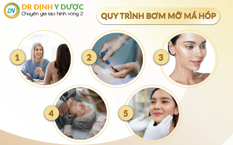 quy trình bơm mỡ má hóp