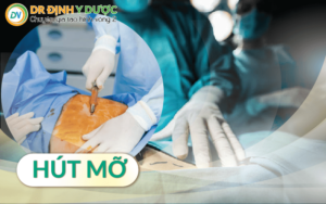 bước 4 hút mỡ