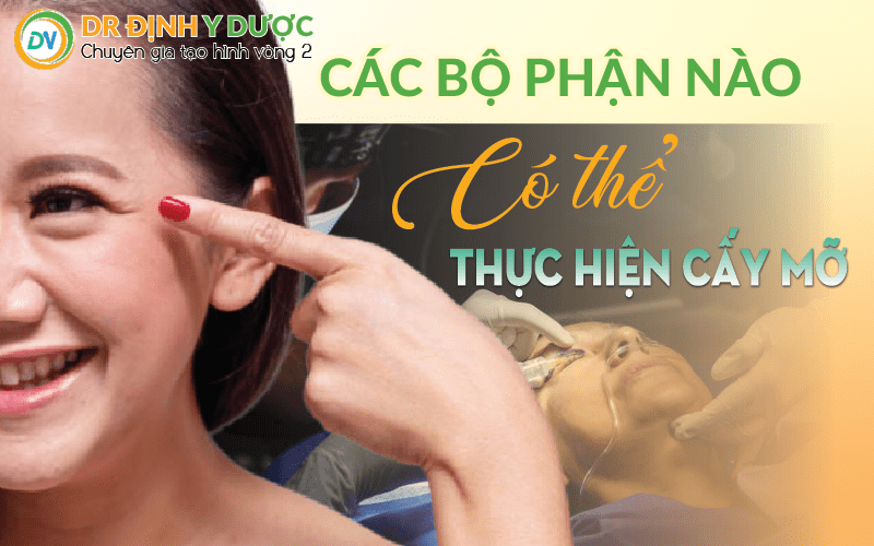 các bộ phận có thể thực hiện cấy mỡ mí mắt trên