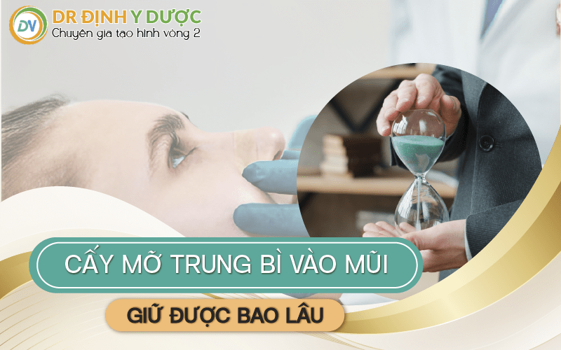 cấy mỡ trung bì vào mũi giữ được bao lâu?