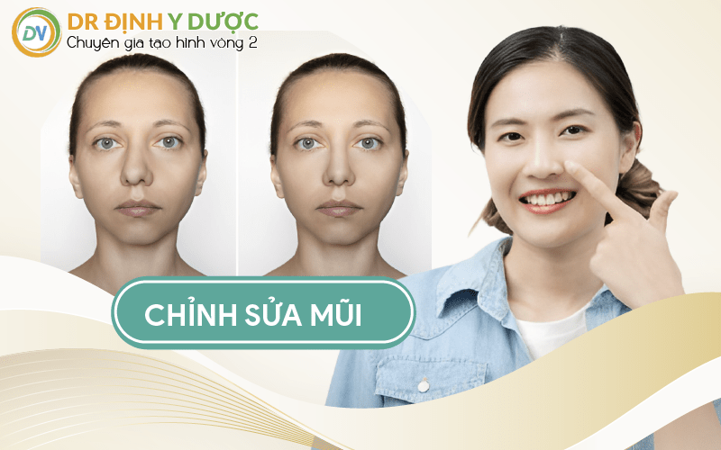 cấy mỡ trung bì vào mũi để chỉnh sửa mũi