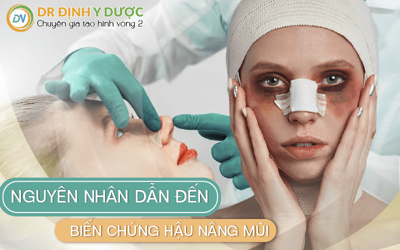 nguyên nhân dẫn đến biến chứng hậu nâng mũi