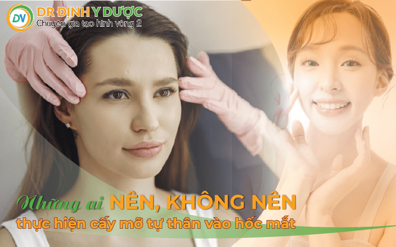 những ai nên, không nên thực hiện cấy mỡ tự thân vào hốc mắt