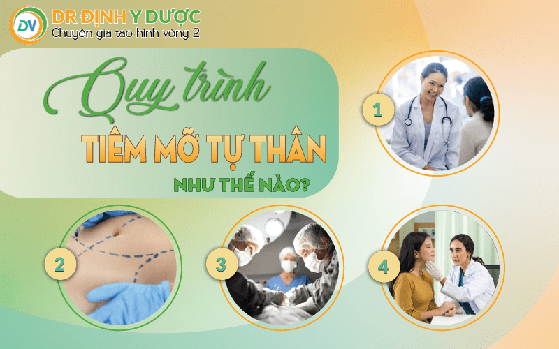 quy trình tiêm mỡ tự thân như thế nào