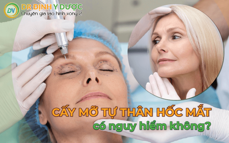 cấy mỡ tự thân vào hốc mắt có nguy hiểm không