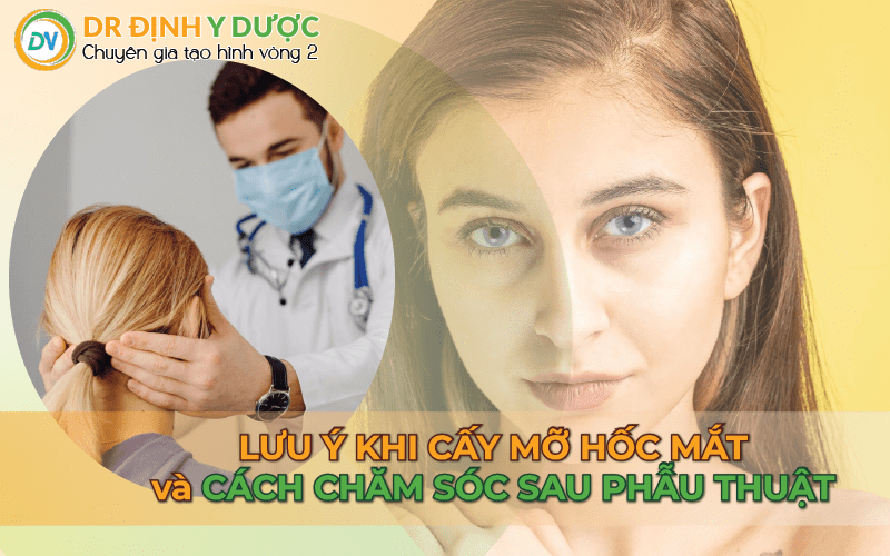 lưu ý khi cấy mỡ tự thân vào hốc mắt