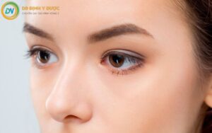 Hốc Mắt Sâu: Nguyên Nhân Và Cách Khắc Phục Hốc Mắt Sâu Tự Nhiên