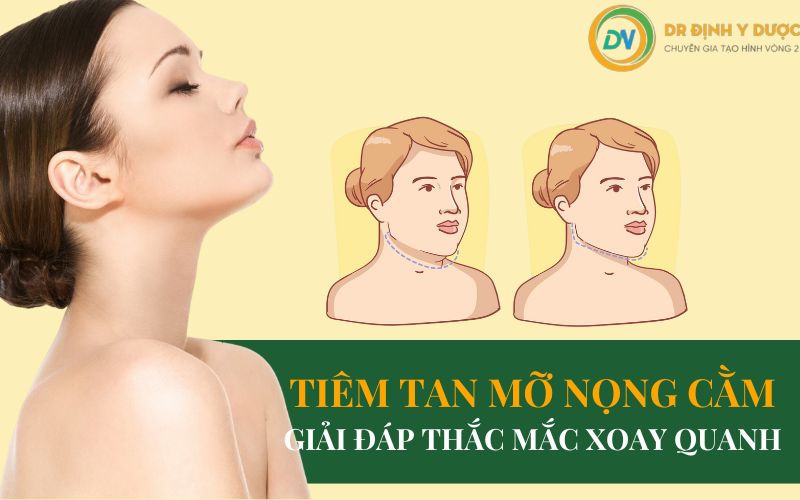 tiêm tan mỡ nọng cằm