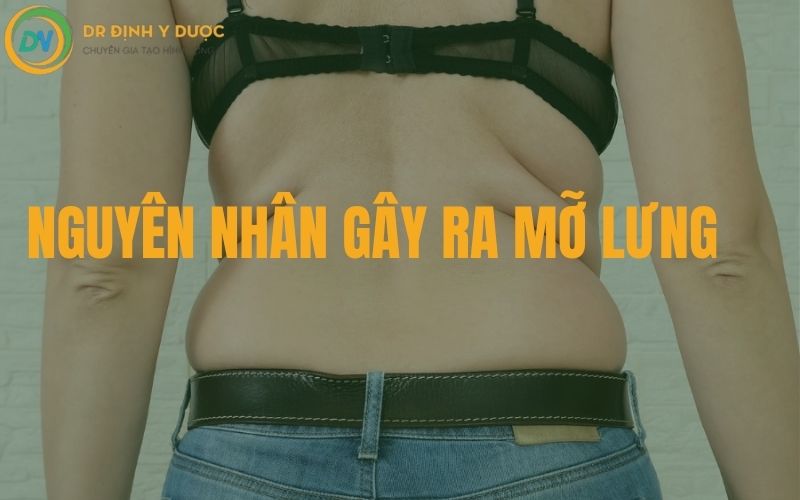 nguyên nhân gây ra mỡ lưng