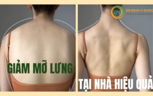 Cách Giảm Mỡ Lưng Hiệu Quả Tại Nhà: Áp Dụng Bài Tập Và Phương Pháp Massage Giảm Mỡ Lưng