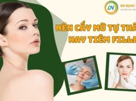 nên cấy mỡ tự thân hay tiêm filler