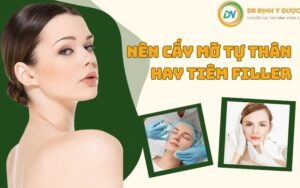 Nên Cấy Mỡ Tự Thân Hay Tiêm Filler - Tìm Hiểu Hai Phương Pháp Làm Đẹp Đang Được Săn Đón Hiện Nay