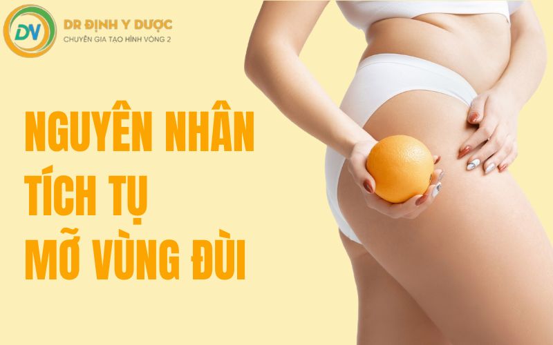 nguyên nhân gây mỡ đùi