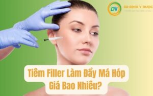 Tiêm Filler Má Giá Bao Nhiêu? Giải Pháp Cho Má Hóp - Má Xệ