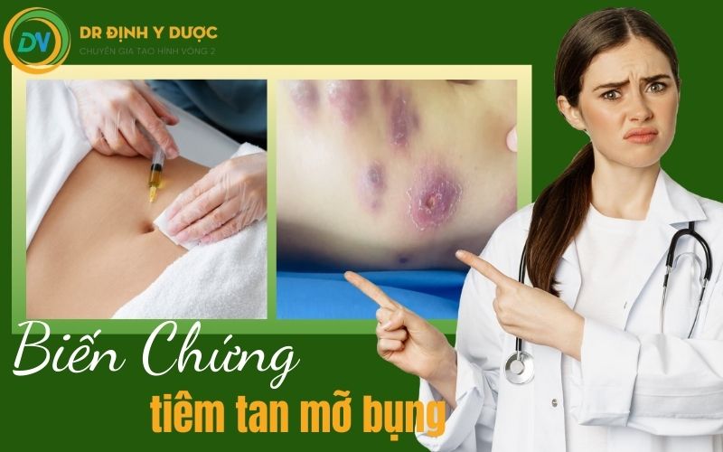 biến chứng tiêm tan mỡ bụng