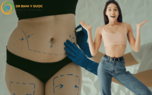 Hút Mỡ Bụng Bao Lâu Thì Lành - Thời Gian Hồi Phục Sau Hút Mỡ