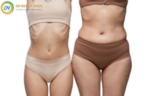 Cách Giảm Mỡ Hai Bên Hông: Bí Quyết Giúp Vòng Eo Thon Gọn