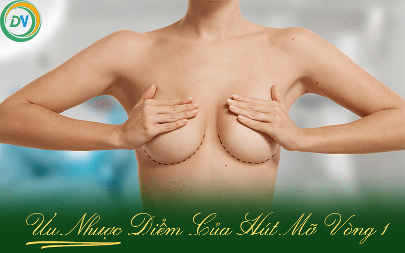 ưu nhược điểm của hút mỡ vòng 1