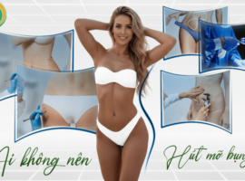 ai không nên hút mỡ bụng