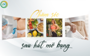 Chăm Sóc Sau Hút Mỡ Bụng Giúp Nhanh Hồi Phục Và Duy Trì Vóc Dáng Lâu Dài