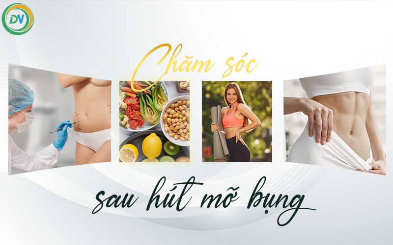 Chăm Sóc Sau Hút Mỡ Bụng Giúp Nhanh Hồi Phục Và Duy Trì Vóc Dáng Lâu Dài chăm sóc sau hút mỡ bụng