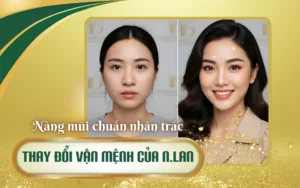 review nâng mũi nhân trắc học