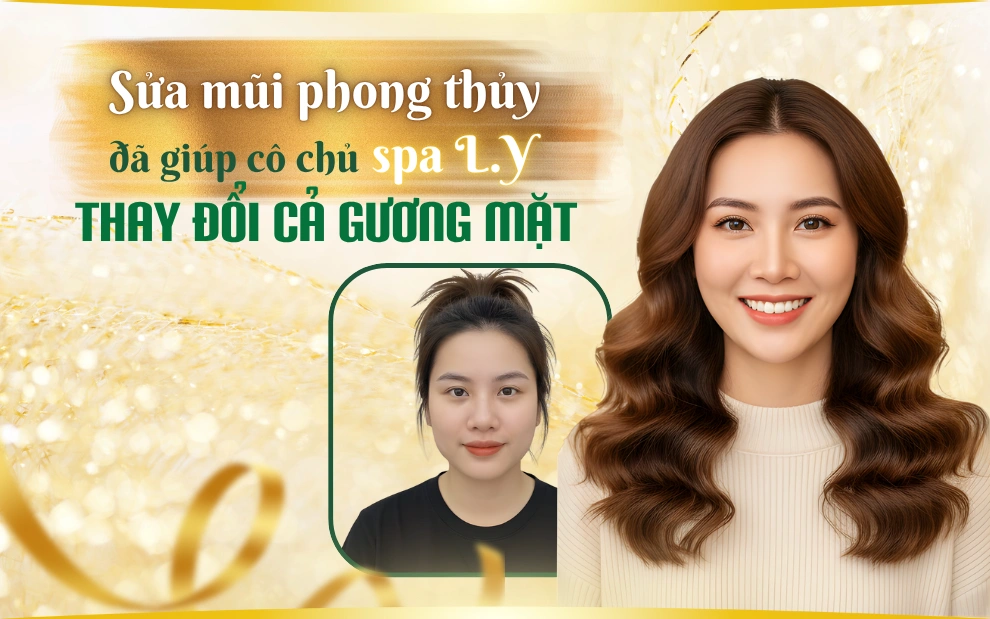 review nâng mũi nhân trắc học