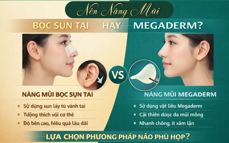 Tìm Hiểu Chi Tiết Nâng Mũi Nên Bọc Sụn Tai Hay Sụn Megaderm? Nâng mũi nên bọc sụn tai hay sụn Megaderm