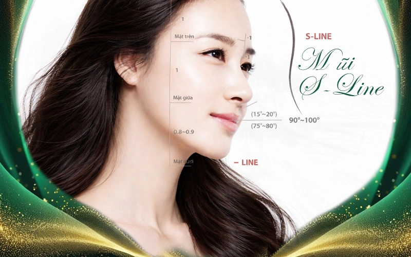 nâng mũi s line là gì