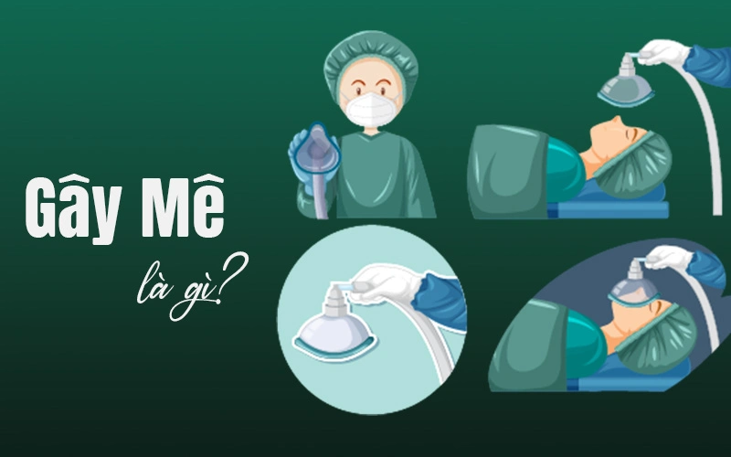 nâng mũi gây mê là gì