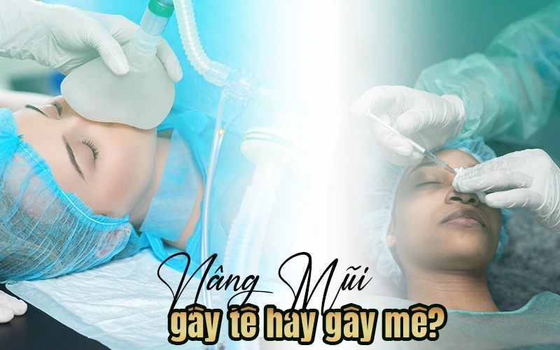 nâng mũi gây tê hay gây mê