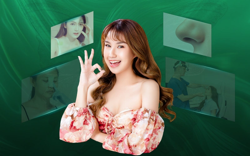 quy trình nâng mũi bán cấu trúc